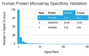 Analysis of HuProt(TM) microarray containing more than 19,000 full-length human proteins using Prolactin antibody (clone PRL/2644). These results demonstrate the foremost specificity of the PRL/2644 mAb. Z- and S- score: The Z-score represents the strength of a signal that an antibody (in combination with a fluorescently-tagged anti-IgG secondary Ab) produces when binding to a particular protein on the HuProt(TM) array. Z-scores are described in units of standard deviations (SD's) above the mean value of all signals generated on that array. If the targets on the HuProt(TM) are arranged in descending order of the Z-score, the S-score is the difference (also in units of SD's) between the Z-scores. The S-score therefore represents the relative target specificity of an Ab to its intended target.
