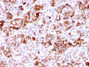 IHC testing of FFPE human pituitary tissue with Prolactin antibody (clone PRL/2644). Required HIER: boil tissue sections in pH 9 10mM Tris with 1mM EDTA for 10-20 min followed by cooling at RT for 20 min.~