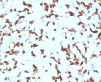 IHC staining of FFPE human liver tissue with Cathepsin D antibody (clone CTPD-1). HIER: boil tissue sections in pH 9 10mM Tris with 1mM EDTA for 10-20 min and allow to cool before testing.~