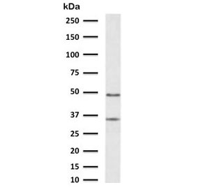 Western blot testing of human liver lysate with