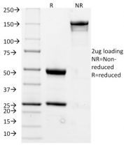 SDS-PAGE analysis of purified, BSA-free CD20 antibody (clone L26) as confirmation of integrity and purity.
