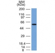 Western blot testing of human MCF7 cell lysate with Occludin antibody. Predicted molecular weight ~59 kDa.
