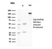 SDS-PAGE analysis of purified, BSA-free Cadherin 17 antibody (clone CDH17/2615) as confirmation of integrity and purity.