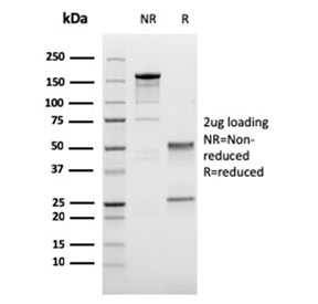 SDS-PAGE analysis of purified, BSA-free Cadherin 17 antibody (clone CDH17/2616) as confirmation of integrity and purity.