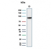 Western blot testing of human small intestine tissue lysate with recombinant Cadherin 17 antibody. Predicted molecular weight ~92 kDa but may be observed at higher molecular weights due to glycosylation.