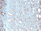 IHC staining of FFPE human colon with Cadherin 17 antibody (clone CDH17/2617). HIER: boil tissue sections in pH 9 10mM Tris with 1mM EDTA for 10-20 min and allow to cool before testing.