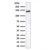 Western blot testing of human small intestine lysate with Cadherin 17 antibody (clone CDH17/2617). Predicted molecular weight ~92 kDa but may be observed at higher molecular weights due to glycosylation.