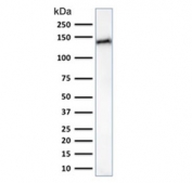 Western blot testing of human small intestine lysate with Cadherin 17 antibody (clone CDH17/2617). Expected molecular weight ~120 kDa.