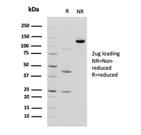 SDS-PAGE analysis of purified, BSA-free Cadherin 17 antibody (clone CDH17/2618) as confirmation of integrity and purity.