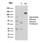 SDS-PAGE analysis of purified, BSA-free Cadherin 17 antibody (clone CDH17/2618) as confirmation of integrity and purity.