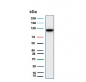 Western blot testing of human small intestine tissue with Cadherin 17 antibody. Predicted molecular weight ~92 kDa but may be observed at higher molecular weights due to glycosylation.