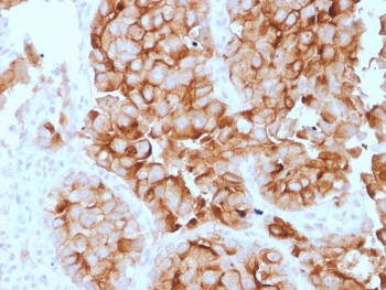 IHC staining of FFPE human lung mes
