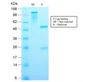 SDS-PAGE analysis of purified, BSA-free recombinant p21 antibody (clone CIP1/2489R) as confirmation of integrity and purity.
