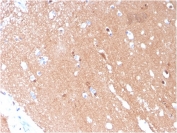 IHC staining of FFPE human brain with TUBB3 antibody (TUBB3/3731). HIER: boil tissue sections in pH 9 10mM Tris with 1mM EDTA for 10-20 min and allow to cool before testing.