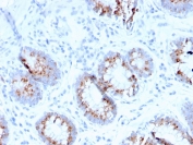 IHC staining of FFPE human colon with MerTK  antibody (clone MERTK/3015). HIER: boil tissue sections in pH 9 10mM Tris with 1mM EDTA for 10-20 min and allow to cool before testing.