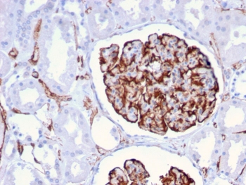 IHC staining of FFPE human kidney with Nestin antibody (clone NES/2911). HIER: boil tissue sections in pH 9 10mM Tris with 1mM EDTA for 10-20 min and allow to cool before testing.