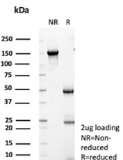 CFTR Antibody SDS-PAGE. SDS-PAGE analysis of purified CFTR antibody, clone CFTR/1342, under non-reducing (NR) and reducing (R) conditions with 2 ug protein loading. The non-reduced sample shows a predominant band corresponding to intact immunoglobulin, while the reduced sample resolves into bands consistent with heavy and light chains, confirming structural integrity and purity of this CFTR antibody.