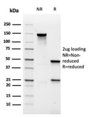 MALT1 Antibody SDS-PAGE. SDS-PAGE analysis of purified MALT1 antibody, clone rMT1/410, under non-reducing (NR) and reducing (R) conditions with 2 ug protein loading. The non-reduced sample shows a predominant band corresponding to intact immunoglobulin, while the reduced sample resolves into bands consistent with heavy and light chains, confirming the purity and structural integrity of this MALT1 antibody.