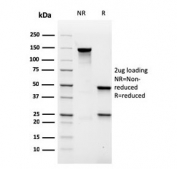 SDS-PAGE analysis of purified, BSA-free recombinant MALT1 antibody (clone rMT1/410) as confirmation of integrity and purity.