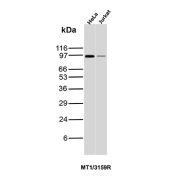 MALT1 Antibody WB HeLa Jurkat. Western blot analysis of Mucosa associated lymphoid tissue lymphoma translocation protein 1 / MALT1 expression in human HeLa and Jurkat cell lysates using MALT1 antibody clone MT1/3159R. A band is detected at approximately the expected molecular weight for MALT1 in both cell lines, consistent with expression of the full-length protein, with signal intensity reflecting relative expression levels between samples.