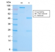 SDS-PAGE analysis of purified, BSA-free recombinant MALT1 antibody (clone MT1/3159R) as confirmation of integrity and purity.