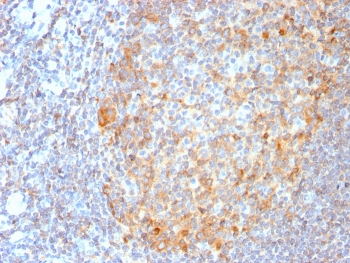 IHC staining of FFPE human tonsil tissue with recombinant MALT1 antibody (clone MT1/3159R). Required HIER: boil tissue sections in pH 9 10mM Tris with 1mM EDTA for 10-20 min.~