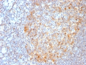 IHC staining of FFPE human tonsil tissue with recombinant MALT1 antibody (clone MT1/3159R). Required HIER: boil tissue sections in pH 9 10mM Tris with 1mM EDTA for 10-20 min.