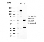 SDS-PAGE analysis of purified, BSA-free UPK1A antibody (clone UPK1A/2921) as confirmation of integrity and purity.