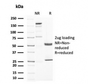 SDS-PAGE analysis of purified, BSA-free UPK1A antibody (clone UPK1A/2922) as confirmation of integrity and purity.