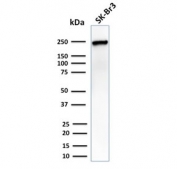 Western blot testing of human SK-BR-3 cells with CHD4 antibody. Predicted molecular weight ~260 kDa.