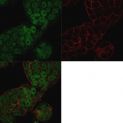 Immunofluorescent staining of permeabilized human MCF7 cells with CHD4 antibody (clone 3F2/4, green) and Phalloidin (red).