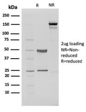 SDS-PAGE analysis of purified, BSA-free CHD4 antibody (clone 3F2/4) as confirmation of integrity and purity.