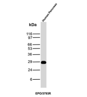 EPO Antibody Human Pancreas WB. Western blot analysis of human pancreas tissue lysate using EPO Antibody (clone EPO/3793R) detects a band at approximately 28-30 kDa, consistent with erythropoietin (EPO) and its glycosylated forms, supporting detection in human pancreatic tissue.