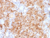 IHC staining of FFPE human parathyroid gland with Chromogranin A antibody. HIER: boil tissue sections in pH 9 10mM Tris with 1mM EDTA for 10-20 min and allow to cool before testing.