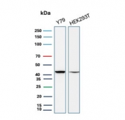 Western blot testing of human Y79 and HEK293 cell lysate with CKB antibody (clone CPTC-CKB-2). Predicted molecular weight ~43 kDa.