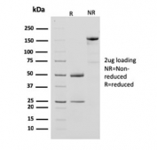 SDS-PAGE analysis of purified, BSA-free CKB antibody (clone CPTC-CKB-2) as confirmation of integrity and purity.
