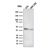 Western blot testing of human Y79 and HEK293 cell lysate with CKB antibody (clone CPTC-CKB-2). Predicted molecular weight ~43 kDa.