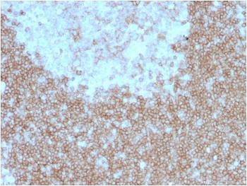 IHC staining of FFPE human tonsil with BAFF Receptor antibody (clone BAFFR/1557). HIER: boil tissue sections in pH 9 10mM Tris with 1mM EDTA for 10-20 min and allow to cool before testing.~
