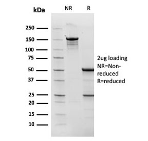 SDS-PAGE analysis of purified, BSA-free TOP1MT antibody (clone TOP1MT/568) as confirmation of integrity and purity.