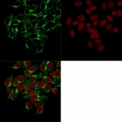 Immunofluorescent staining of permeabilized human HeLa cells with Clathrin Heavy Chain antibody (clone CHC/1432, green) and Reddot nuclear stain (red).