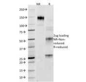 SDS-PAGE analysis of purified, BSA-free Adipophilin antibody (clone ADFP/1365) as confirmation of integrity and purity.