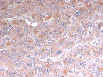 IHC staining of FFPE human adrenal tissue with recombinant Adipophilin antibody (clone rADFP/1493). HIER: boil tissue sections in pH 9 10mM Tris with 1mM EDTA for 10-20 min and allow to cool before testing.~