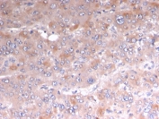 IHC staining of FFPE human adrenal tissue with recombinant Adipophilin antibody (clone rADFP/1493). HIER: boil tissue sections in pH 9 10mM Tris with 1mM EDTA for 10-20 min and allow to cool before testing.