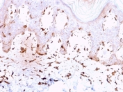 IHC staining of FFPE human skin with Collagen VII antibody (clone LH7.2). HIER: boil tissue sections in pH 9 10mM Tris with 1mM EDTA for 10-20 min and allow to cool before testing.