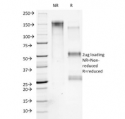 SDS-PAGE analysis of purified, BSA-free Collagen VII antibody (clone LH7.2) as confirmation of integrity and purity.