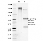 SDS-PAGE analysis of purified, BSA-free Collagen VII antibody (clone LH7.2) as confirmation of integrity and purity.