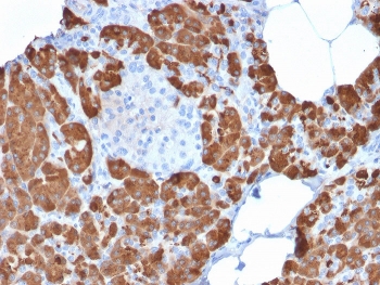 IHC staining of FFPE human pancreas with CPA1 antibody. HIER: boil tissue sections in pH 9 10mM Tris with 1mM EDTA for 10-20 min and allow to cool before testing.