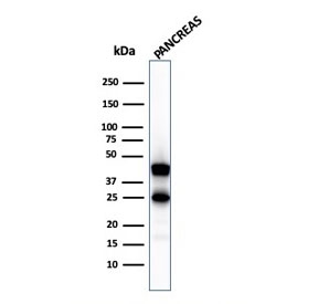 Western blot testing of human pancreas lysate with CPA1 antibody (clone. Predicted molecular weight ~47 kDa.