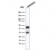 Western blot testing of human pancreas lysate with Carboxypeptidase A1 antibody (clone CPA1/2713). Predicted molecular weight ~47 kDa.