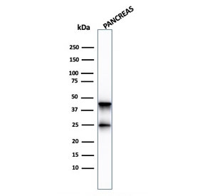Western blot testing of human pancreas lysate with Carboxypeptidase A1 antibody (clone CPA1/2713). Predicted molecular weight ~47 kDa.